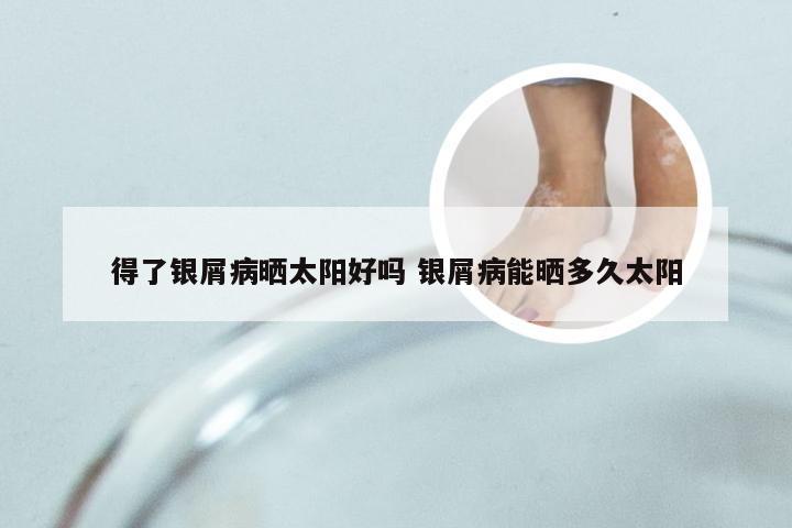 得了银屑病晒太阳好吗 银屑病能晒多久太阳