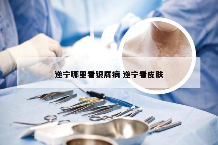 遂宁哪里看银屑病 遂宁看皮肤
