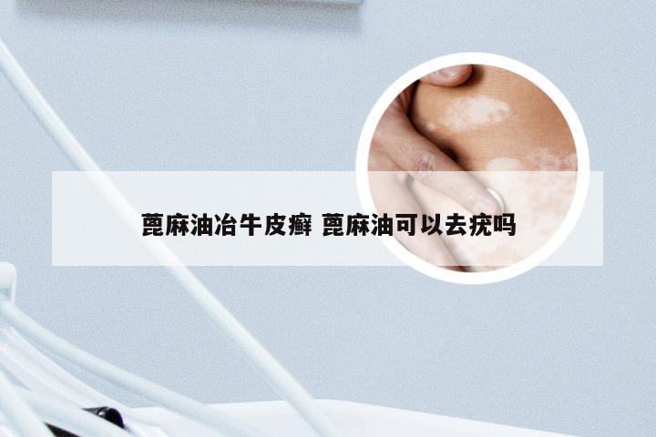 蓖麻油冶牛皮癣 蓖麻油可以去疣吗