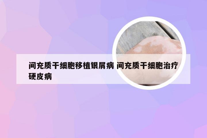 间充质干细胞移植银屑病 间充质干细胞治疗硬皮病