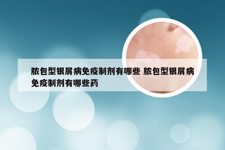 脓包型银屑病免疫制剂有哪些 脓包型银屑病免疫制剂有哪些药