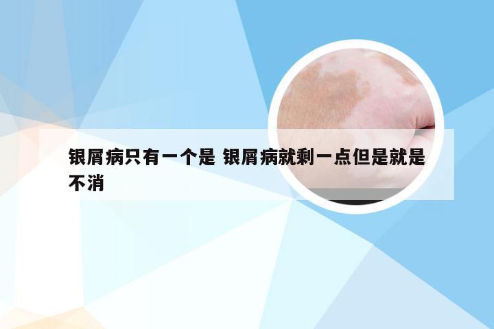 银屑病只有一个是 银屑病就剩一点但是就是不消