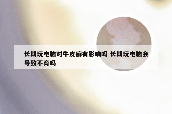 长期玩电脑对牛皮癣有影响吗 长期玩电脑会导致不育吗