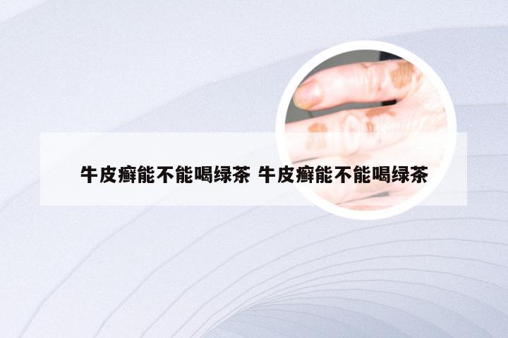 牛皮癣能不能喝绿茶 牛皮癣能不能喝绿茶