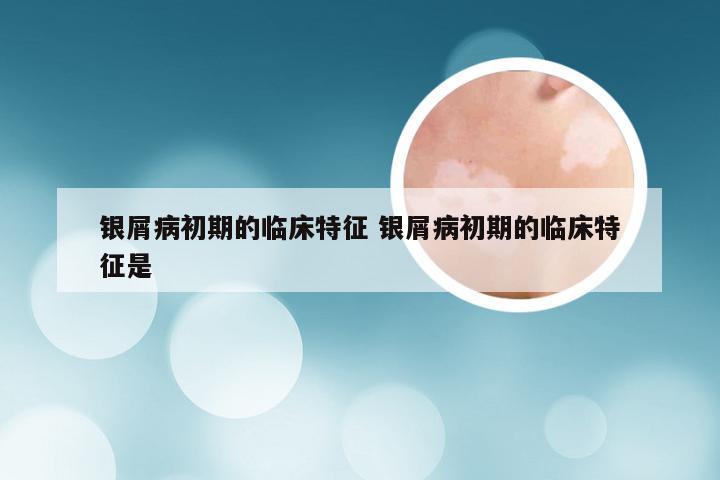 银屑病初期的临床特征 银屑病初期的临床特征是