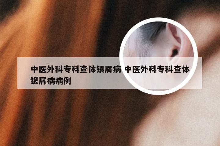中医外科专科查体银屑病 中医外科专科查体银屑病病例