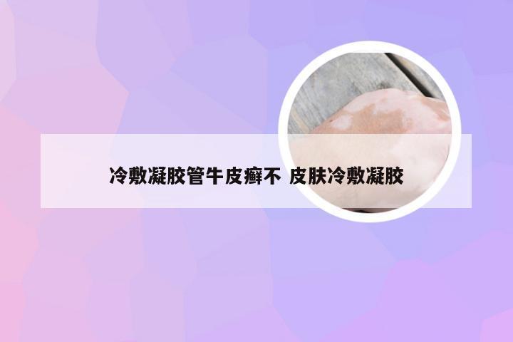 冷敷凝胶管牛皮癣不 皮肤冷敷凝胶