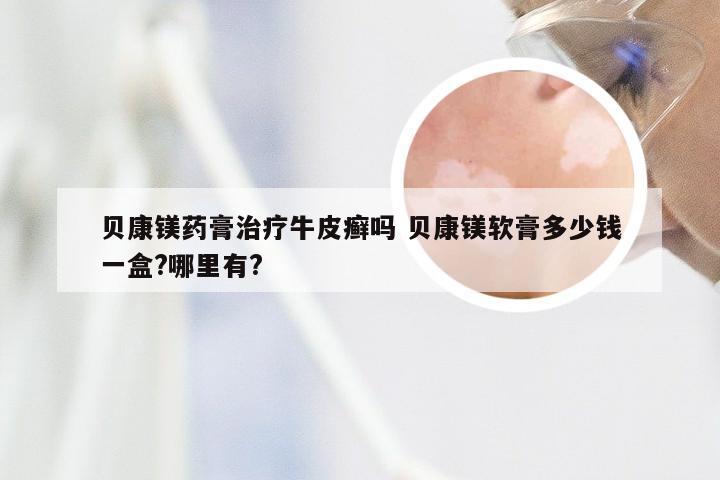 贝康镁药膏治疗牛皮癣吗 贝康镁软膏多少钱一盒?哪里有?