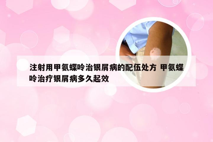 注射用甲氨蝶呤治银屑病的配伍处方 甲氨蝶呤治疗银屑病多久起效