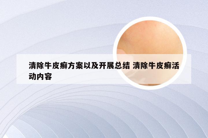 清除牛皮癣方案以及开展总结 清除牛皮癣活动内容