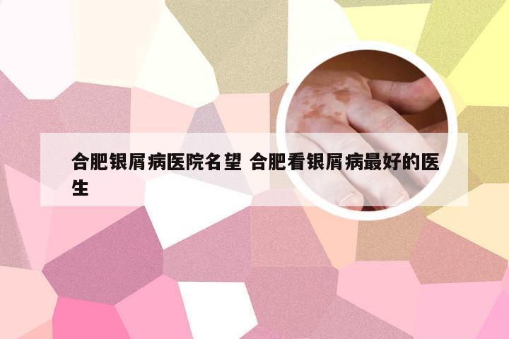 合肥银屑病医院名望 合肥看银屑病最好的医生