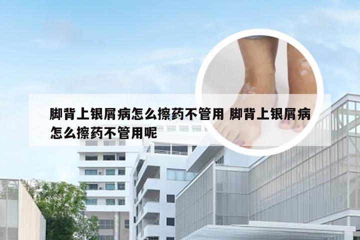 脚背上银屑病怎么擦药不管用 脚背上银屑病怎么擦药不管用呢