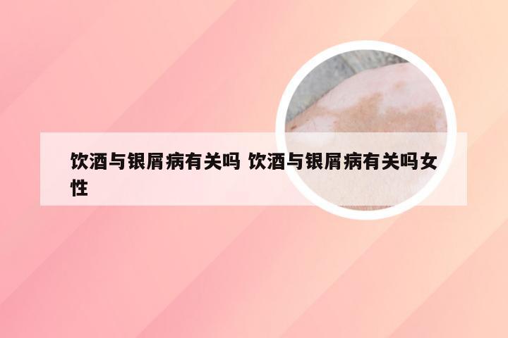 饮酒与银屑病有关吗 饮酒与银屑病有关吗女性