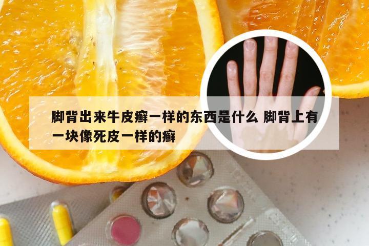 脚背出来牛皮癣一样的东西是什么 脚背上有一块像死皮一样的癣