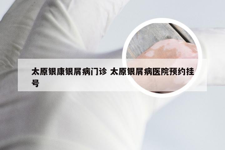 太原银康银屑病门诊 太原银屑病医院预约挂号