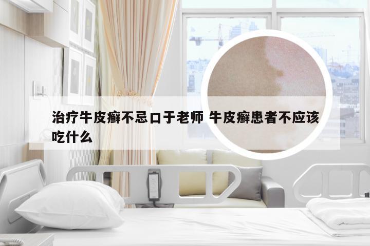治疗牛皮癣不忌口于老师 牛皮癣患者不应该吃什么