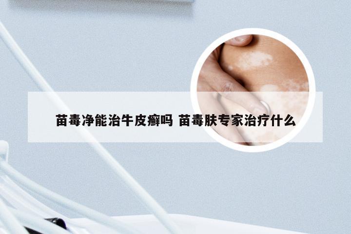 苗毒净能治牛皮癣吗 苗毒肤专家治疗什么