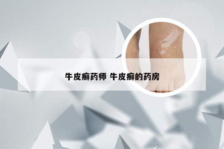牛皮癣药师 牛皮癣的药房