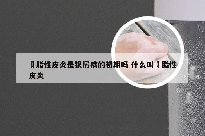 膉脂性皮炎是银屑病的初期吗 什么叫膉脂性皮炎