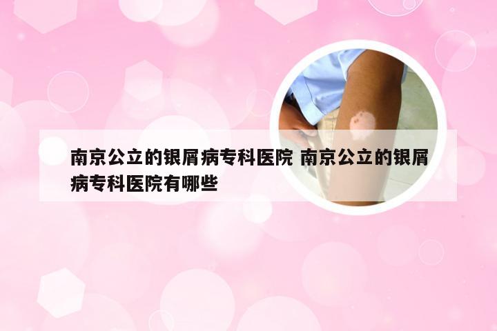 南京公立的银屑病专科医院 南京公立的银屑病专科医院有哪些