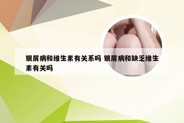 银屑病和维生素有关系吗 银屑病和缺乏维生素有关吗