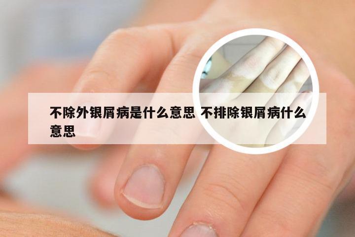 不除外银屑病是什么意思 不排除银屑病什么意思