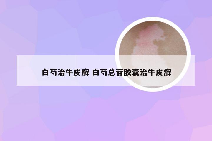 白芍治牛皮癣 白芍总苷胶囊治牛皮癣