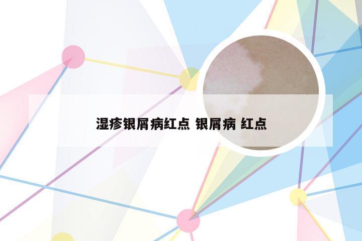 湿疹银屑病红点 银屑病 红点