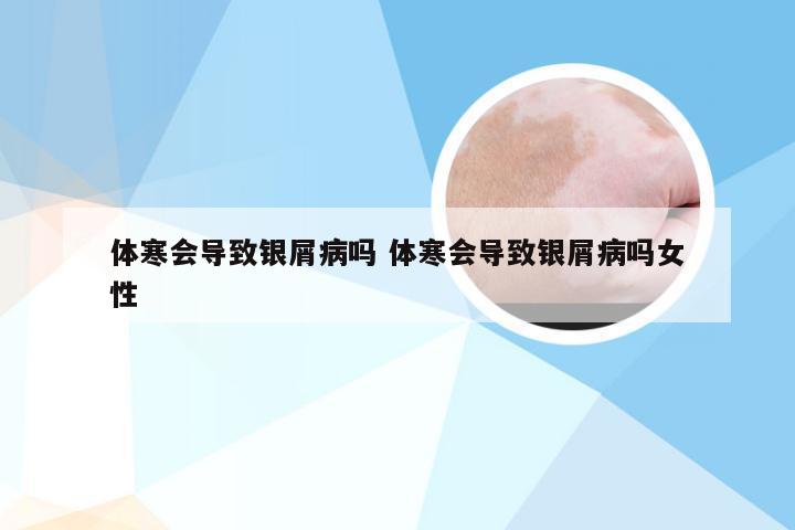 体寒会导致银屑病吗 体寒会导致银屑病吗女性