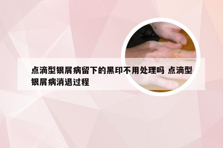 点滴型银屑病留下的黑印不用处理吗 点滴型银屑病消退过程