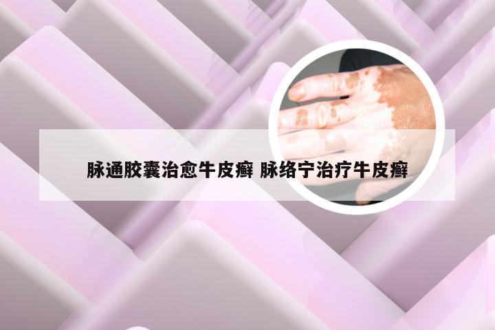 脉通胶囊治愈牛皮癣 脉络宁治疗牛皮癣