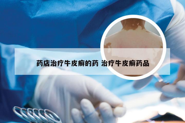 药店治疗牛皮癣的药 治疗牛皮癣药品