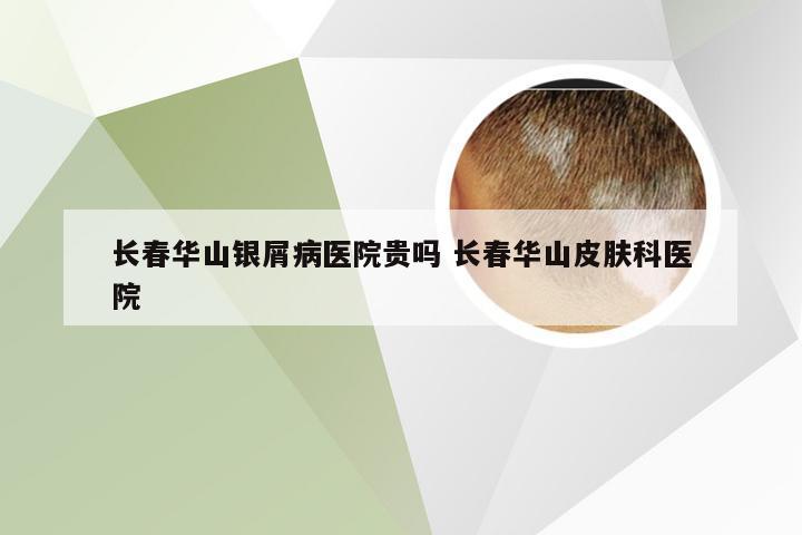 长春华山银屑病医院贵吗 长春华山皮肤科医院