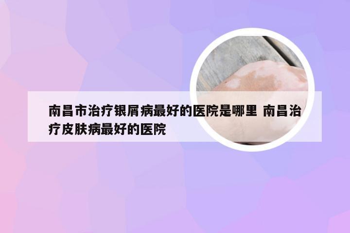 南昌市治疗银屑病最好的医院是哪里 南昌治疗皮肤病最好的医院