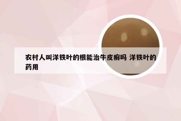 农村人叫洋铁叶的根能治牛皮癣吗 洋铁叶的药用