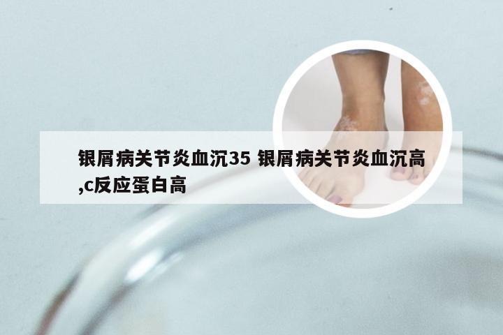 银屑病关节炎血沉35 银屑病关节炎血沉高,c反应蛋白高