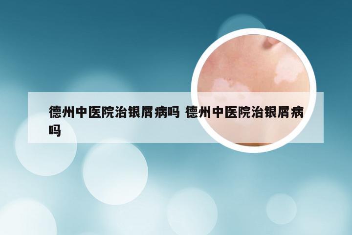 德州中医院治银屑病吗 德州中医院治银屑病吗