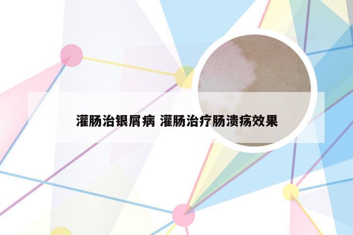 灌肠治银屑病 灌肠治疗肠溃疡效果