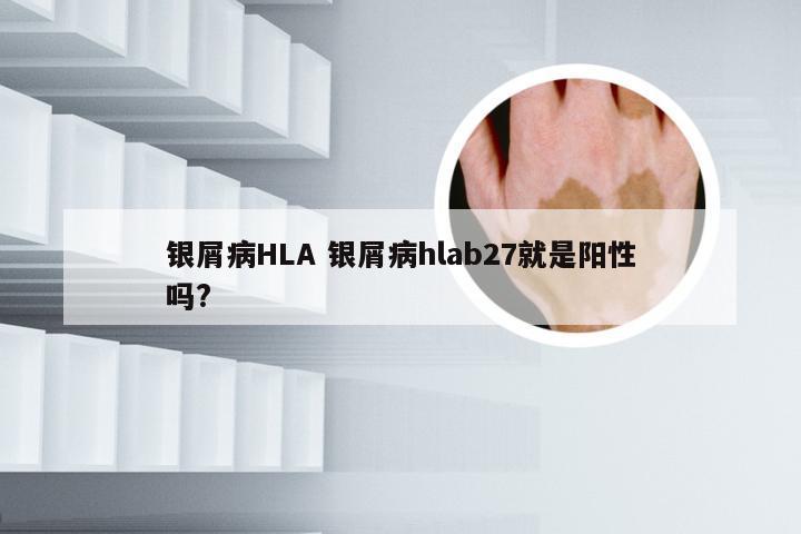 银屑病HLA 银屑病hlab27就是阳性吗?