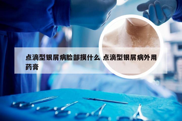 点滴型银屑病脸部摸什么 点滴型银屑病外用药膏