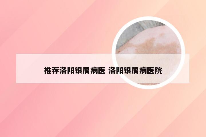推荐洛阳银屑病医 洛阳银屑病医院