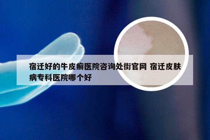宿迁好的牛皮癣医院咨询处街官网 宿迁皮肤病专科医院哪个好