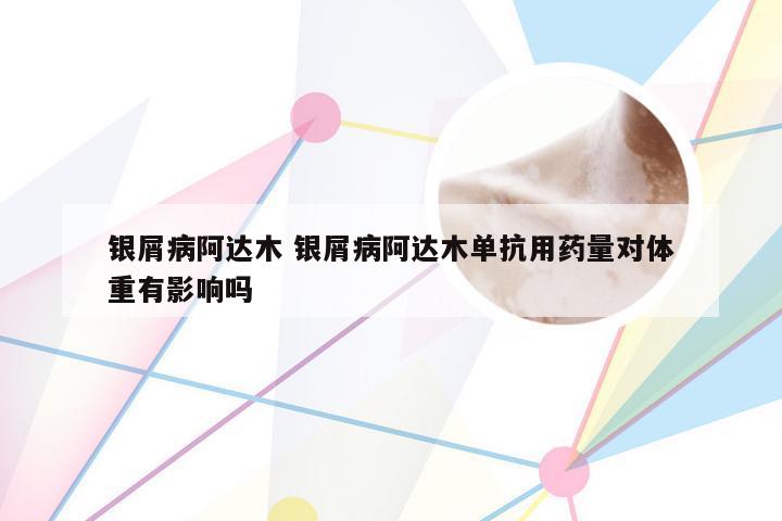 银屑病阿达木 银屑病阿达木单抗用药量对体重有影响吗