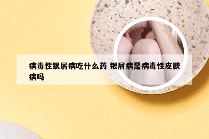 病毒性银屑病吃什么药 银屑病是病毒性皮肤病吗