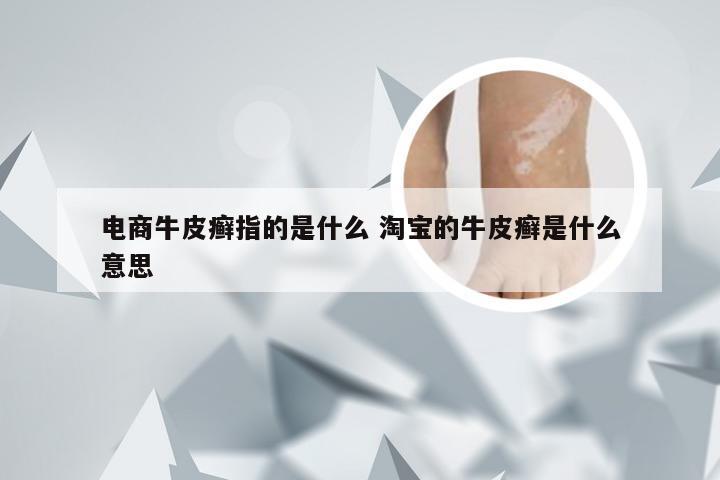 电商牛皮癣指的是什么 淘宝的牛皮癣是什么意思