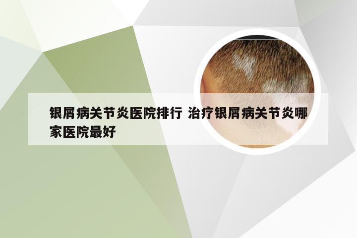 银屑病关节炎医院排行 治疗银屑病关节炎哪家医院最好