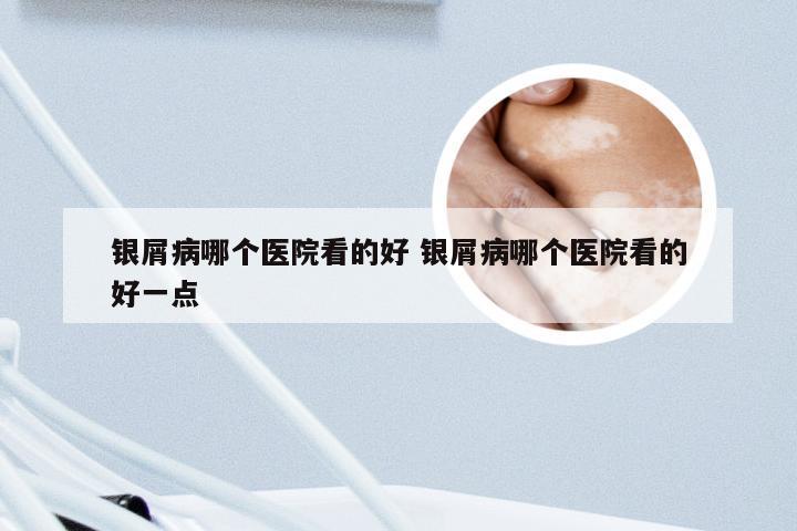 银屑病哪个医院看的好 银屑病哪个医院看的好一点