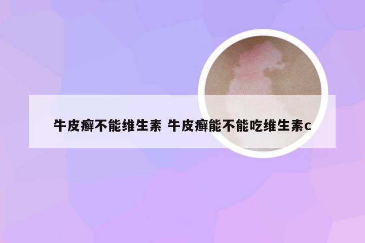 牛皮癣不能维生素 牛皮癣能不能吃维生素c