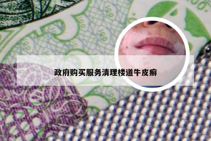 政府购买服务清理楼道牛皮癣