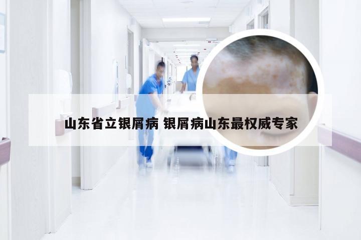 山东省立银屑病 银屑病山东最权威专家